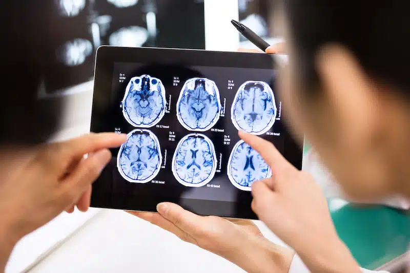 Specialist clinical teams for Spanish device studies